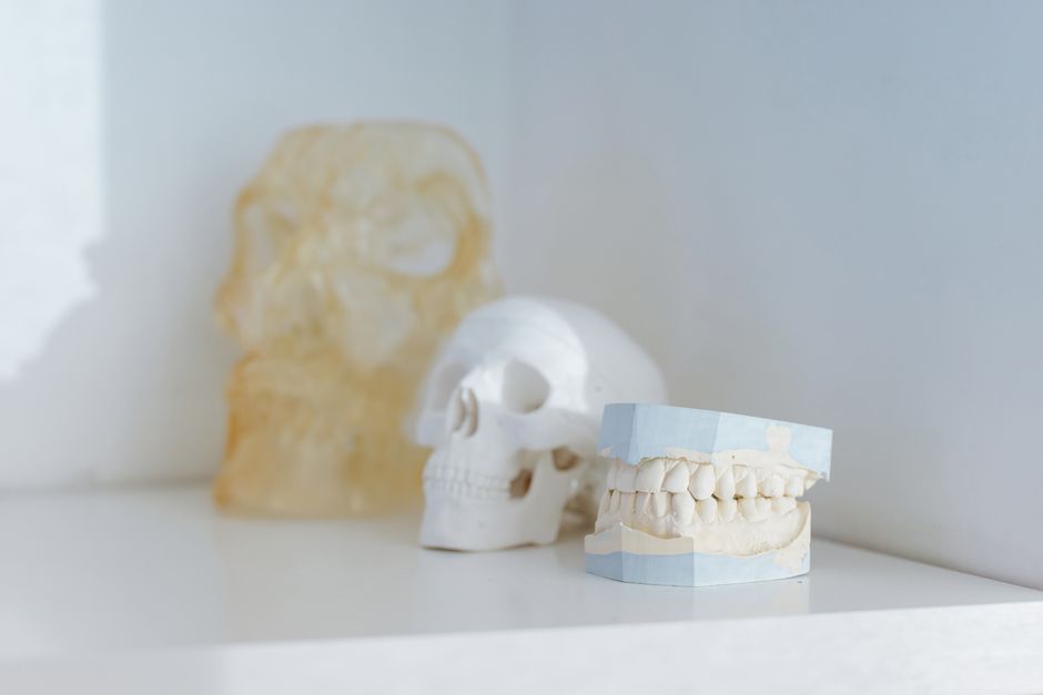 what causes dental bone loss