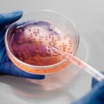 what is alagille syndrome a genetic liver disorder