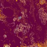 what is cd31 staining and how is it used in diagnosis