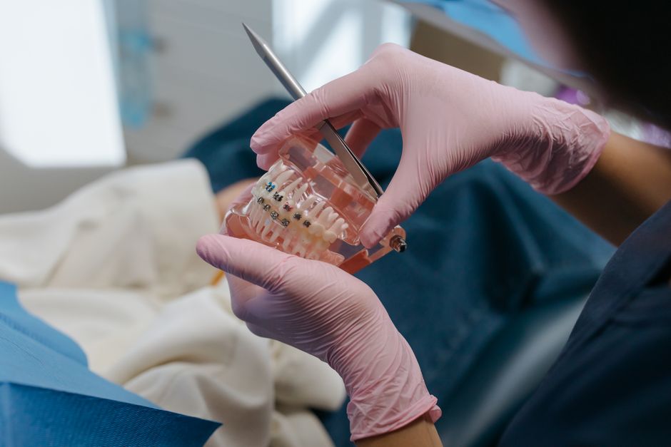 what is ipr in orthodontics procedure explained