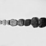 what size kidney stone requires lithotripsy