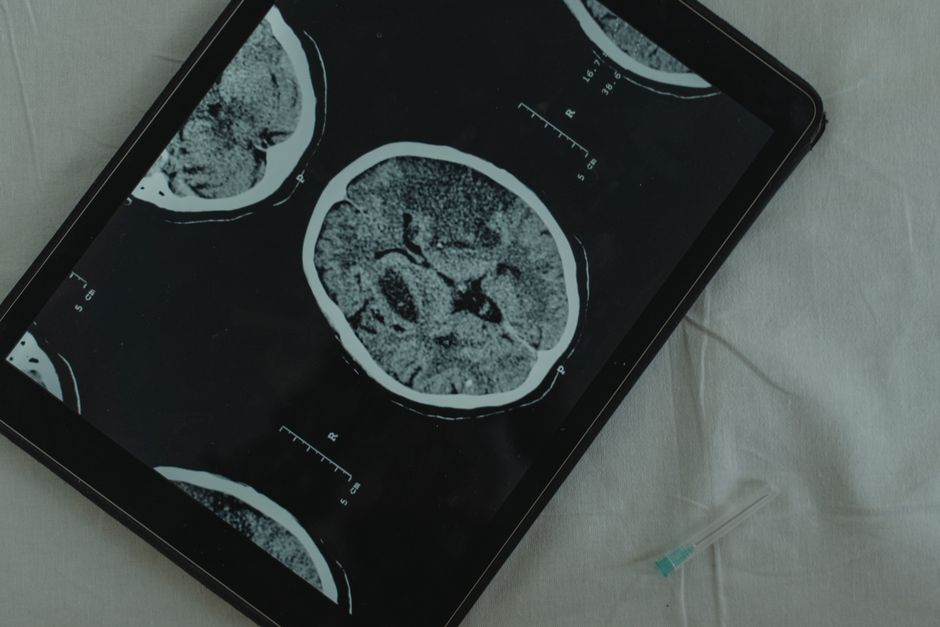 what tests do neurologists do from eeg to imaging