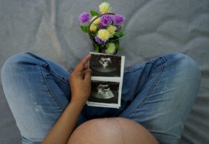 When Does A Miscarriage Become A Stillbirth? 3 when does a miscarriage become a stillbirth