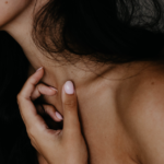 why do skin tags form