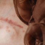 why wont my cuts heal and when should i be concerned