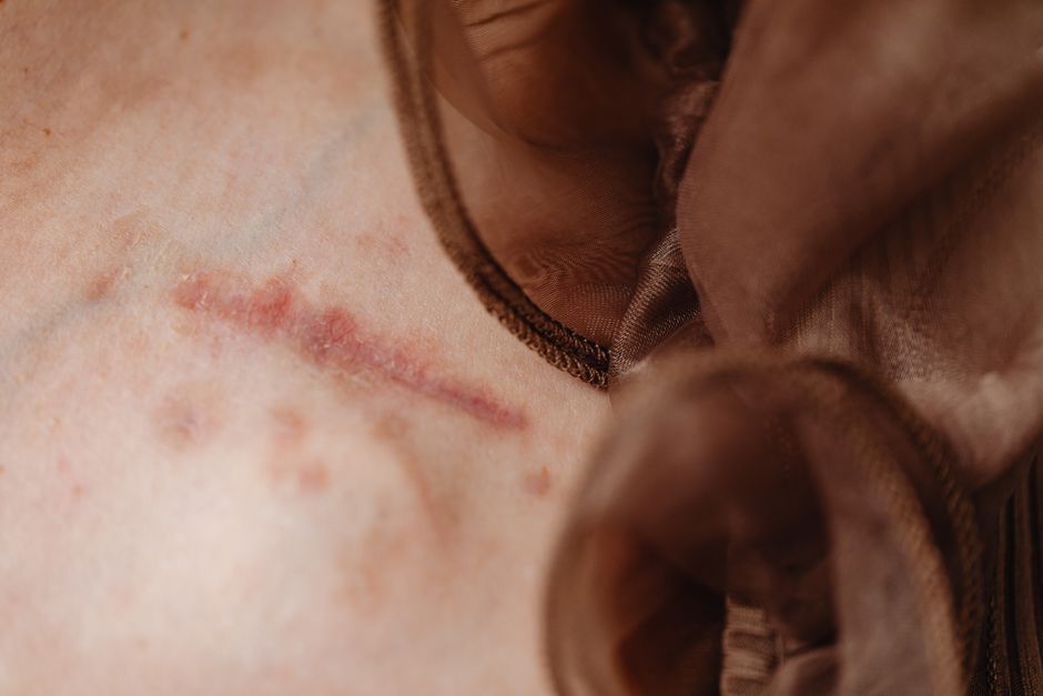 why wont my cuts heal and when should i be concerned