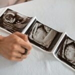 can you see the baby at 5 weeks on an ultrasound