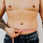 does gastric sleeve cause hair loss and can it stop