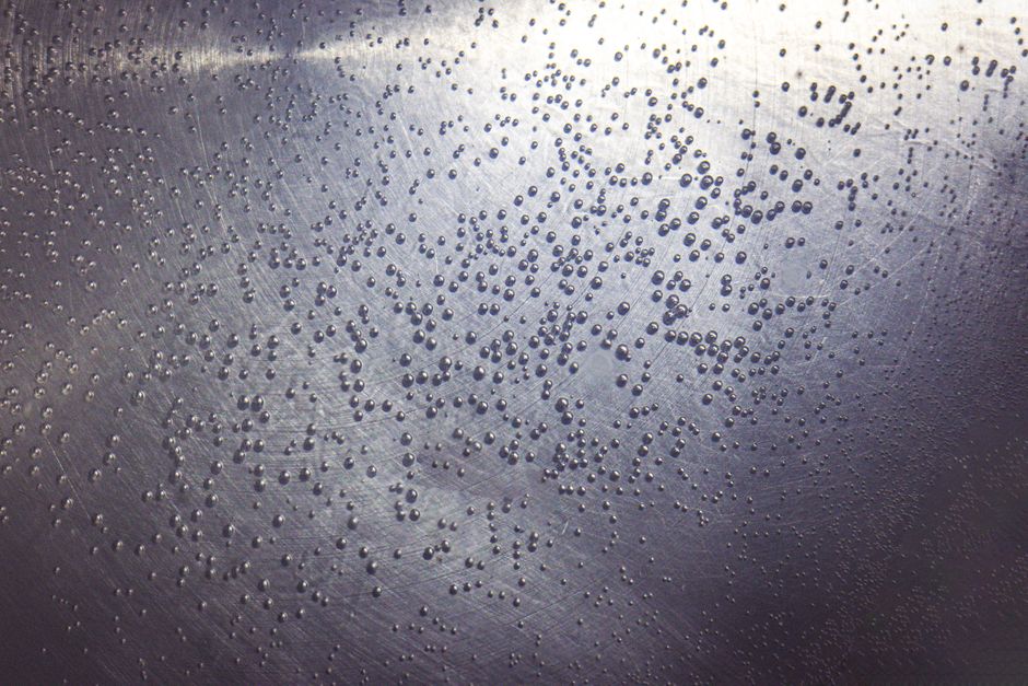 how chromosome condensation works