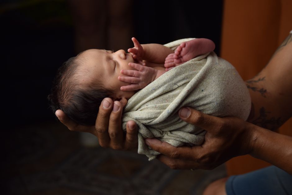 how do you get rid of cradle cap