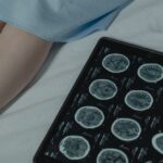 how long does results from a ct scan take