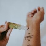 how to get bug bites to go away top treatments