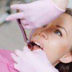 how to get rid of canine teeth without extraction