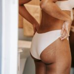 how to stretch skin home methods and medical options