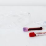 how to treat proteinuria and protect your kidneys