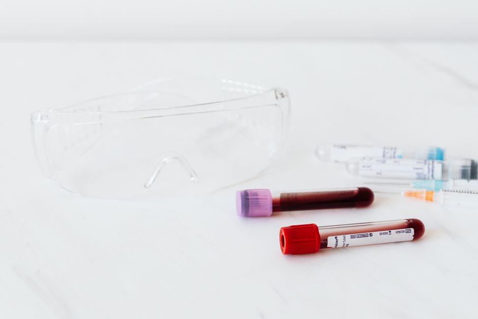 how to treat proteinuria and protect your kidneys