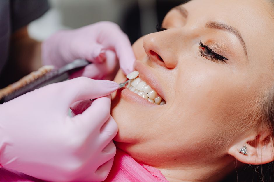 how to whiten composite veneers what actually works