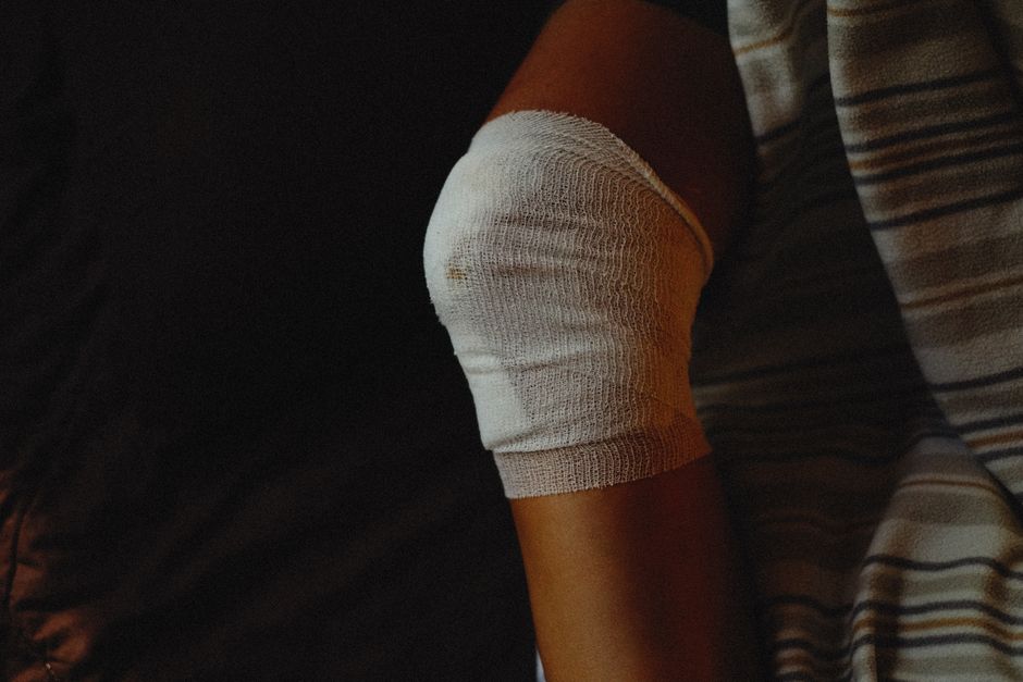 inflammation swelling