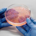 is leprosy a virus or a bacterial infection