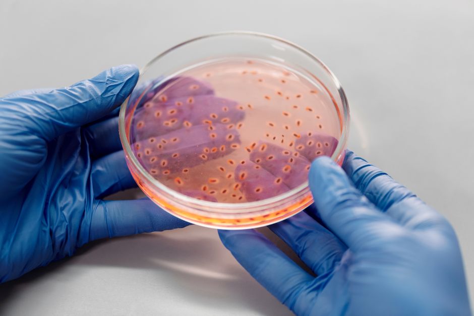 is leprosy a virus or a bacterial infection