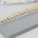 what are laminate veneers and how do they work