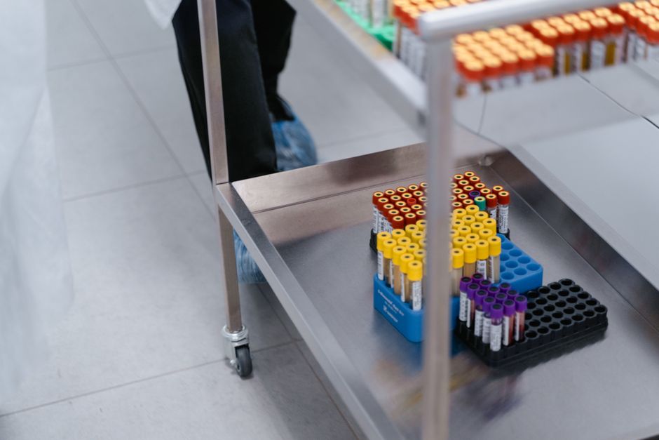 what does urine sample detect