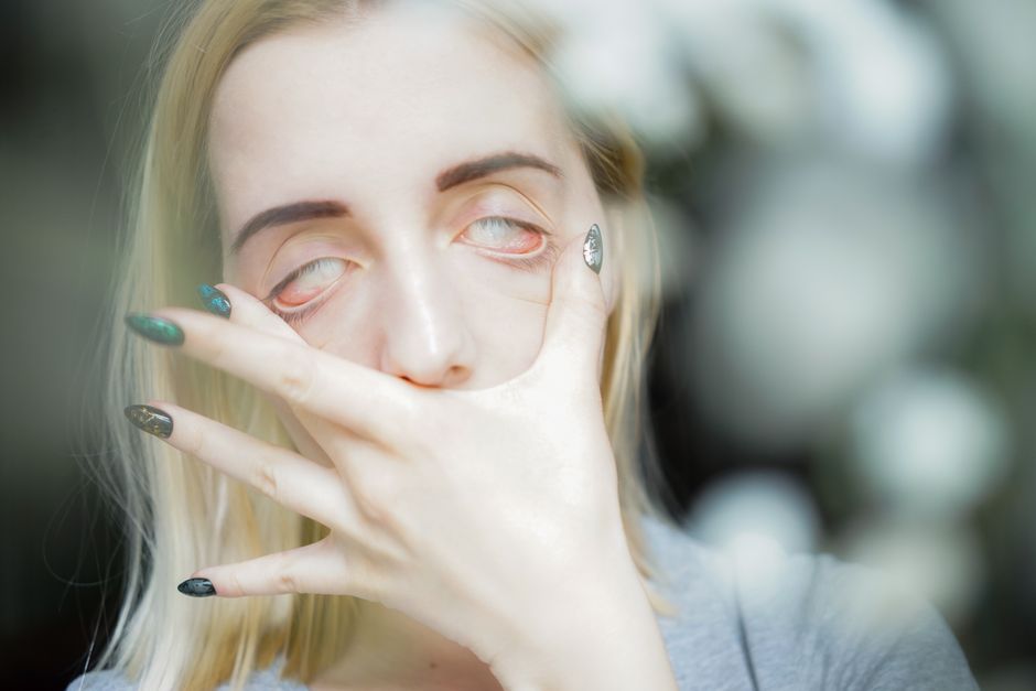 what is atypical trigeminal neuralgia causes treatment