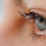 what is blepharitis of the eye