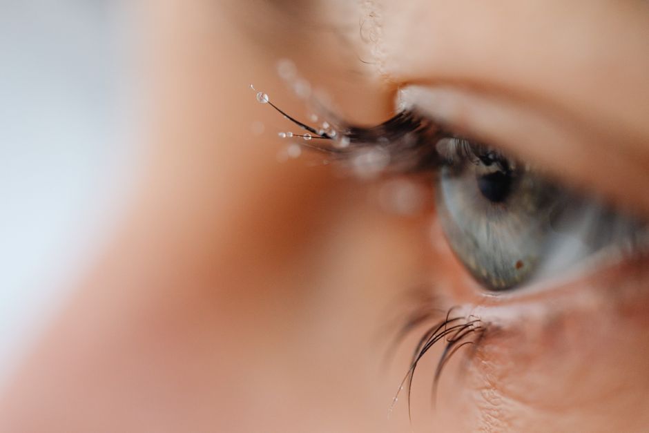 what is blepharitis of the eye